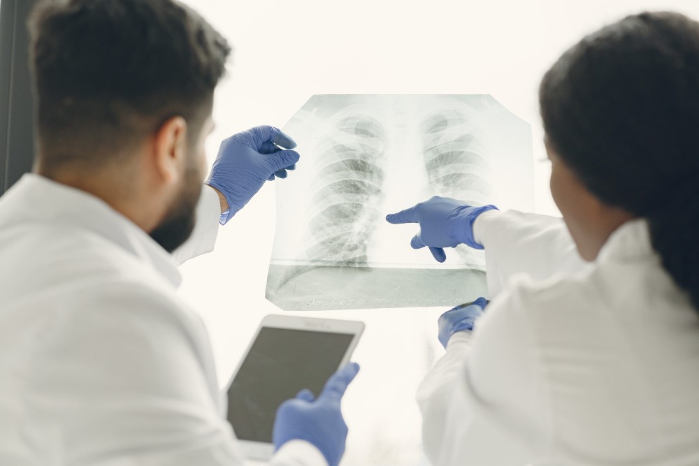 diagnostico precoce cancer de pulmao